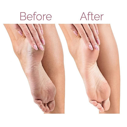 Electric Foot Grinder